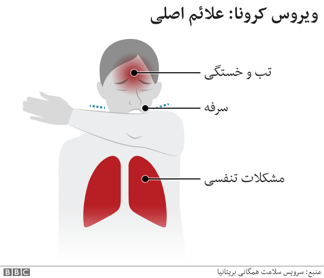 علائم اصلی ویروس کرونا: تب، سرفه، مشکلات تنفسی